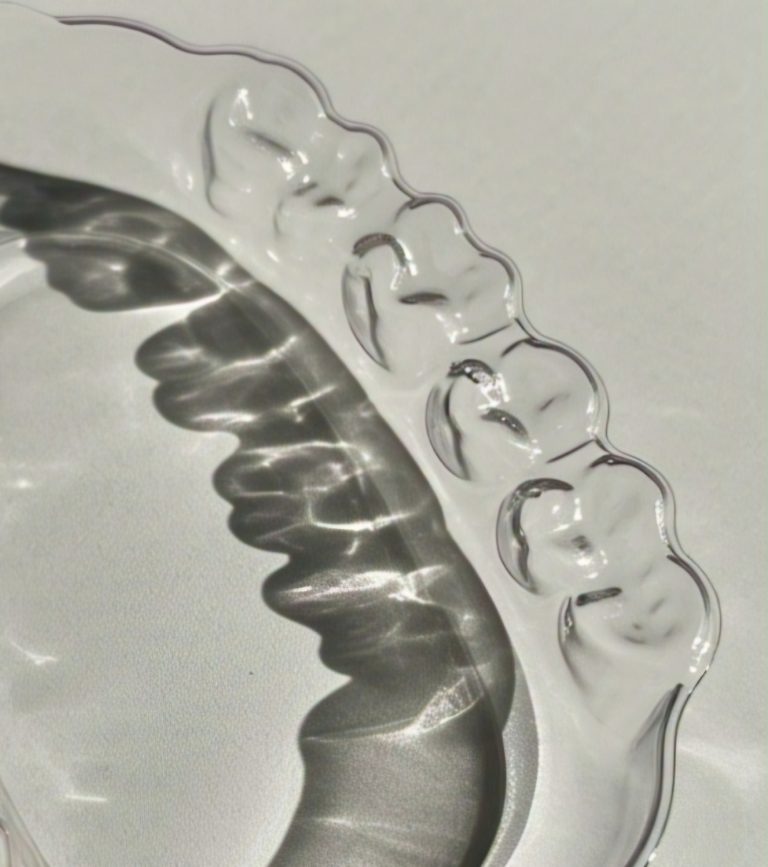 Clear aligner tray used to straighten teeth.